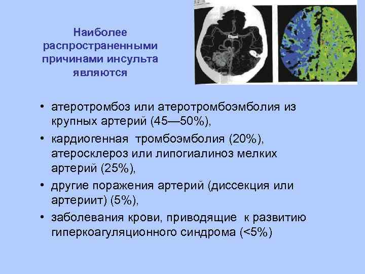 Наиболее распространенными причинами инсульта являются • атеротромбоз или атеротромбоэмболия из крупных артерий (45— 50%),