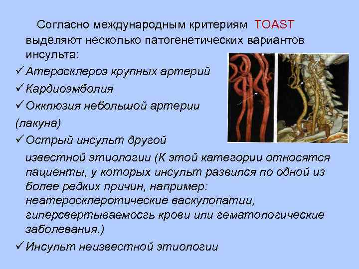  Согласно международным критериям TOAST выделяют несколько патогенетических вариантов инсульта: ü Атеросклероз крупных артерий