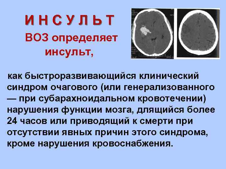 ИНСУЛЬТ ВОЗ определяет инсульт, как быстроразвивающийся клинический синдром очагового (или генерализованного — при субарахноидальном