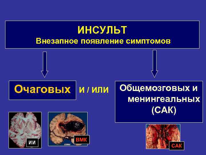 ИНСУЛЬТ Внезапное появление симптомов Очаговых ИИ И / ИЛИ Общемозговых и менингеальных (САК) ВМК