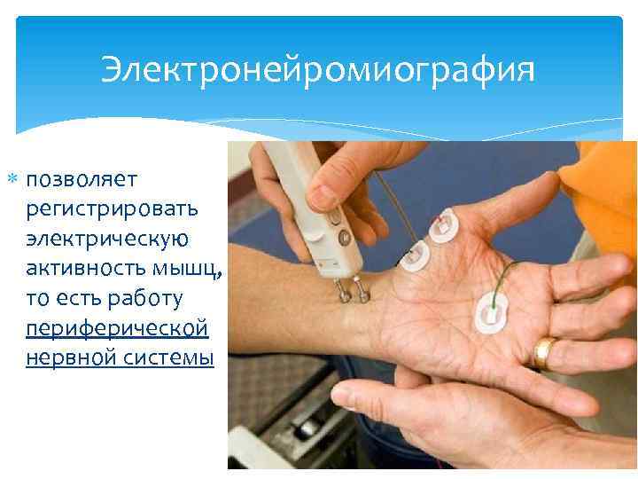 Электронейромиография позволяет регистрировать электрическую активность мышц, то есть работу периферической нервной системы 