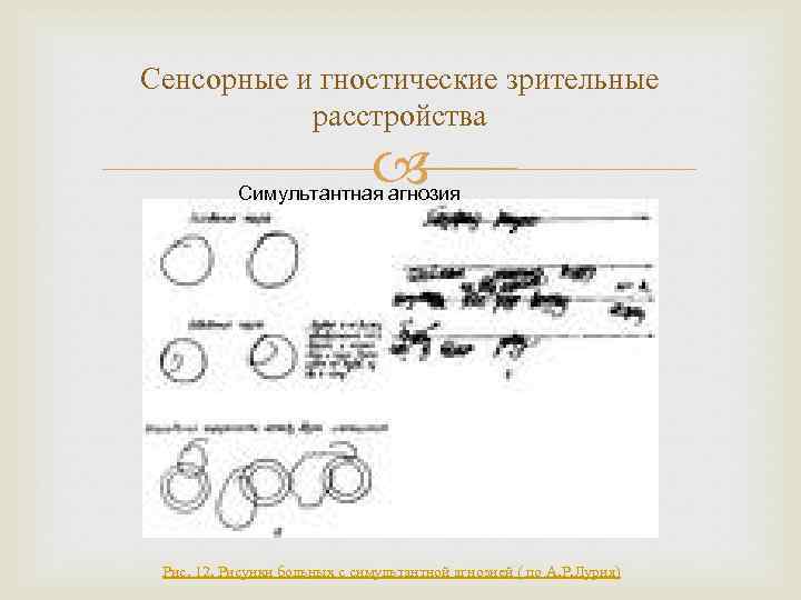 Сенсорные и гностические зрительные расстройства Симультантная агнозия Рис. 12. Рисунки больных с симультантной агнозией