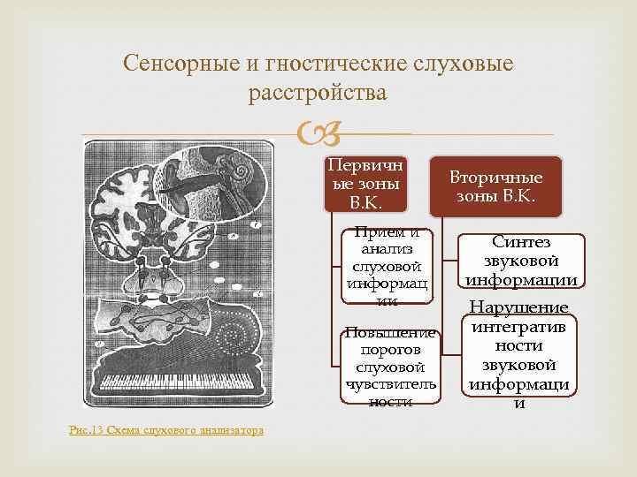 Сенсорные слуховые расстройства презентация