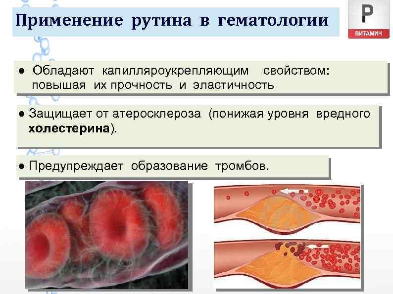 Применение рутина в гематологии ● Обладают капилляроукрепляющим свойством: повышая их прочность и эластичность ●