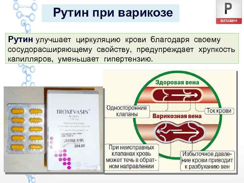 Рутин при варикозе Рутин улучшает циркуляцию крови благодаря своему сосудорасширяющему свойству, предупреждает хрупкость капилляров,