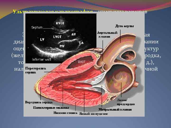 Ультразвуковая кардиография – измерение размеров сердца в динамике. Эхокардиография (Эхо. КГ) — это ультразвуковая
