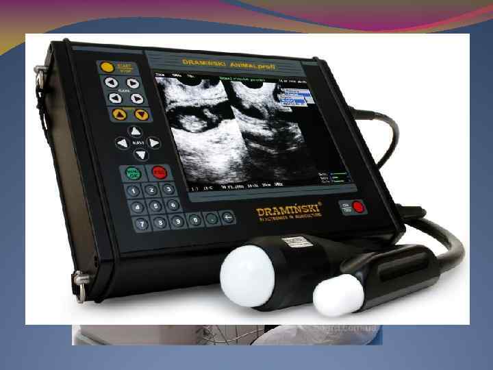 Аппарат ультразвуковой диагностики (УЗИ сканер) — прибор, предназначенный для получения информации о расположении, форме
