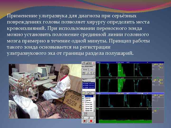 Применение ультразвука для диагноза при серьёзных повреждениях головы позволяет хирургу определить места кровоизлияний. При