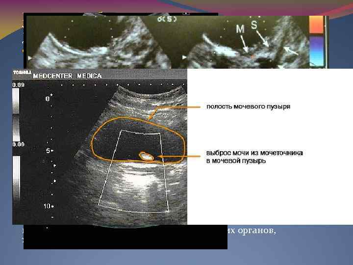 Внутренние болезни Ультразвуковое исследование играет важную роль в постановке диагноза заболеваний внутренних органов, таких
