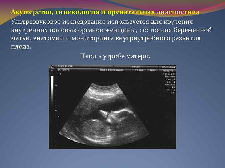 Акушерство, гинекология и пренатальная диагностика Ультразвуковое исследование используется для изучения внутренних половых органов женщины,