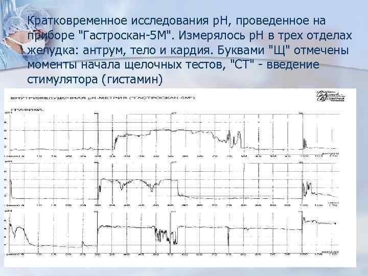 n Кратковременное исследования р. Н, проведенное на приборе 