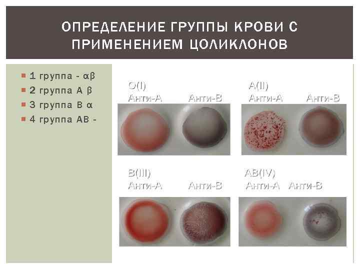 Для определения группы крови необходимо приготовить планшеты с маркировкой