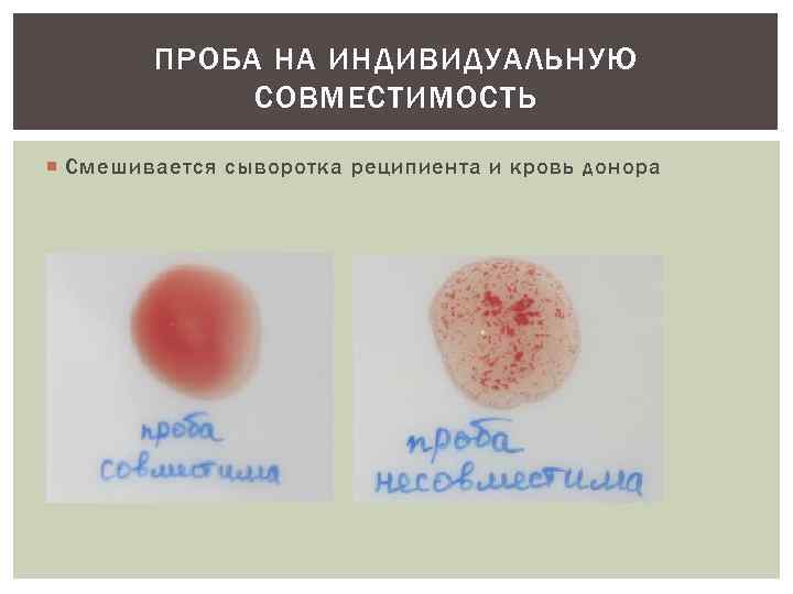 Срыв целки с кровью показать крупным планом