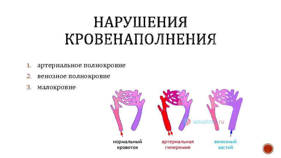 Артериальная гиперемия рисунок