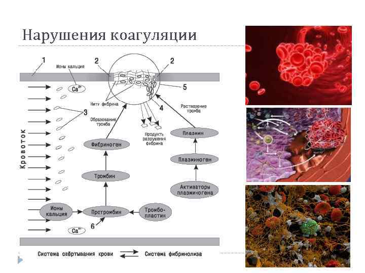 Нарушения коагуляции 