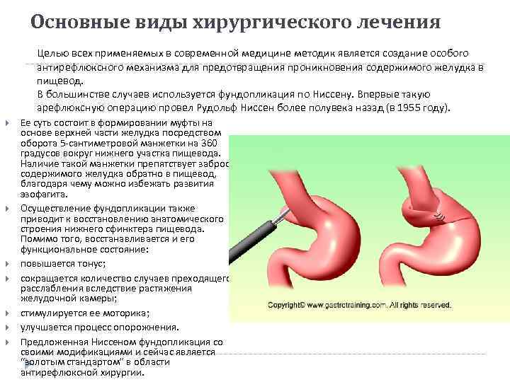 Основные виды хирургического лечения Целью всех применяемых в современной медицине методик является создание особого