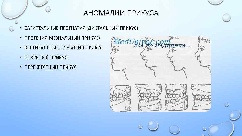 Виды аномалий. Аномалии прикуса глубокий прикус дистальный. Диагностика сагиттальные аномалии прикуса. Вертикальные аномалии прикуса. Сагиттальные аномалии окклюзии.