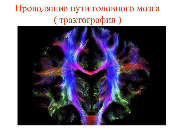 Проводящие пути головного мозга ( трактография ) 