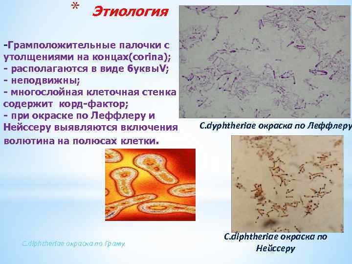 * Этиология -Грамположительные палочки с утолщениями на концах(corina); - располагаются в виде буквы. V;