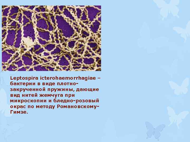 Leptospira icterohaemorrhagiae – бактерии в виде плотнозакрученной пружины, дающие вид нитей жемчуга при микроскопии
