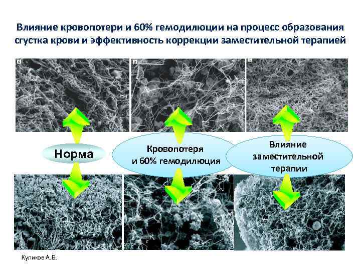 Влияние кровопотери и 60% гемодилюции на процесс образования сгустка крови и эффективность коррекции заместительной