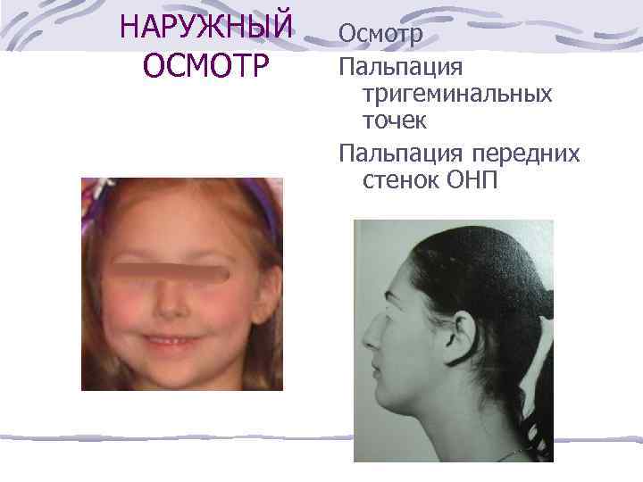 НАРУЖНЫЙ ОСМОТР Осмотр Пальпация тригеминальных точек Пальпация передних стенок ОНП 