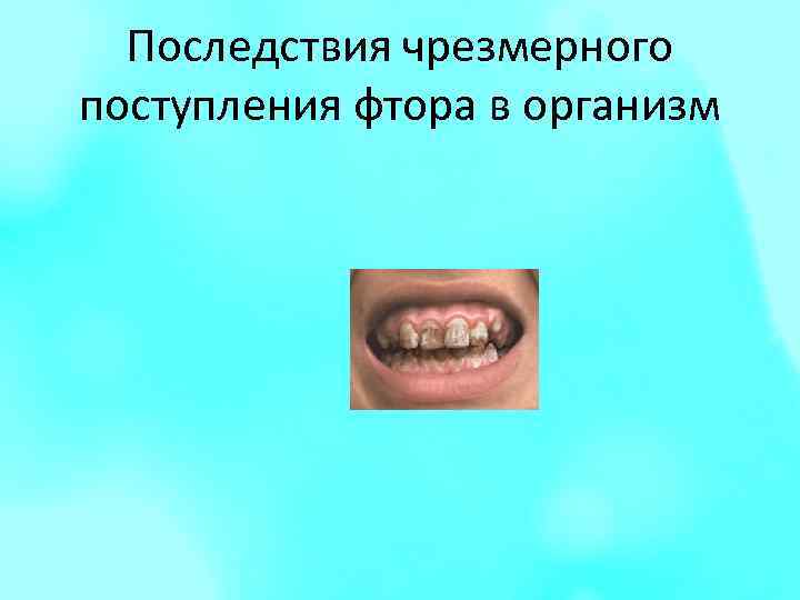 Последствия чрезмерного поступления фтора в организм 
