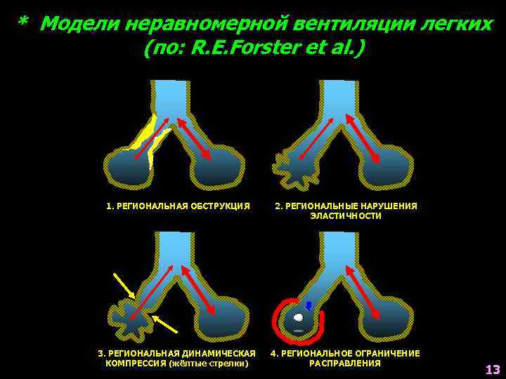 * Модели неравномерной вентиляции легких (по: R. E. Forster et al. ) 1. РЕГИОНАЛЬНАЯ