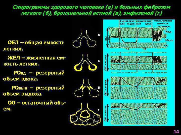 Спирография при астме