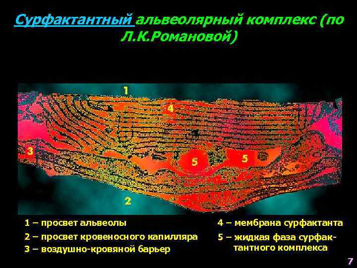 Сурфактантный альвеолярный комплекс (по Л. К. Романовой) 1 – просвет альвеолы 4 – мембрана