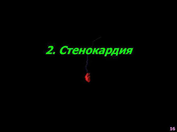 2. Стенокардия 16 
