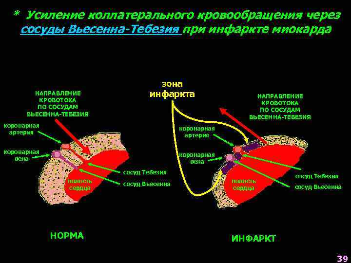 * Усиление коллатерального кровообращения через сосуды Вьесенна-Тебезия при инфаркте миокарда НАПРАВЛЕНИЕ КРОВОТОКА ПО СОСУДАМ