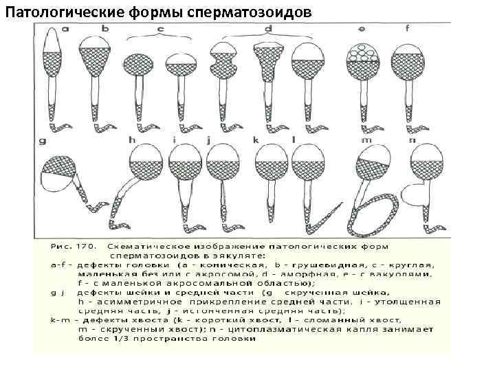 Время созревания спермиев у мужчин для оплодотворения. Патоморфологические формы спермограмма. Патологические формы сперматозоидов Ветеринария. Патологические формы спермиев. Патологические формы спермиев у животных.