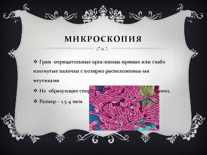 МИКРОСКОПИЯ v Грам отрицательные орга низмы прямые или слабо изогнутые палочки с полярно расположенны