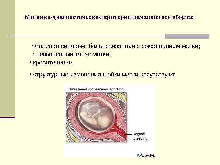 Клинико-диагностические критерии начавшегося аборта: • болевой синдром: боль, связанная с сокращением матки; • повышенный