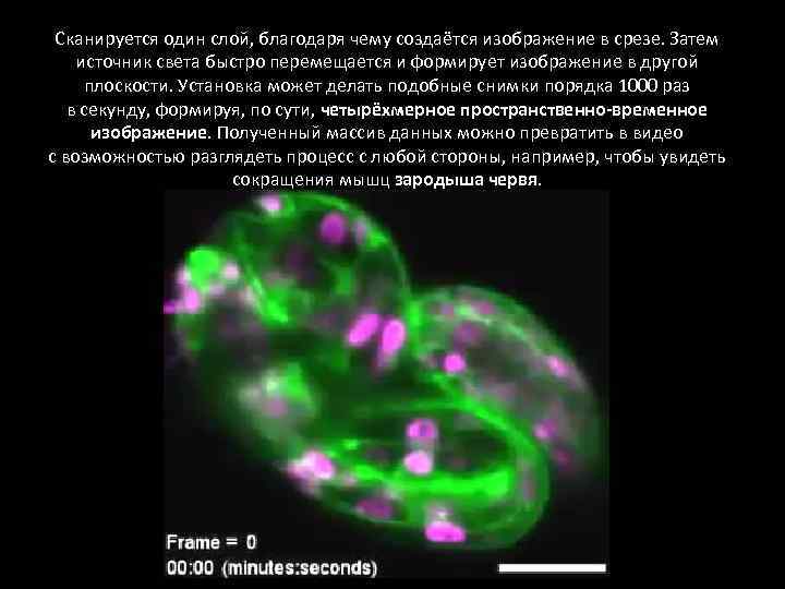 Сканируется один слой, благодаря чему создаётся изображение в срезе. Затем источник света быстро перемещается