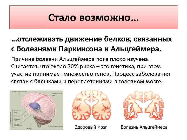 Про альцгеймера и паркинсона