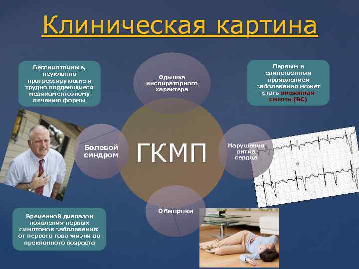 Клиническая картина Бессимптомные, неуклонно прогрессирующие и трудно поддающиеся медикаментозному лечению формы Болевой синдром Временной