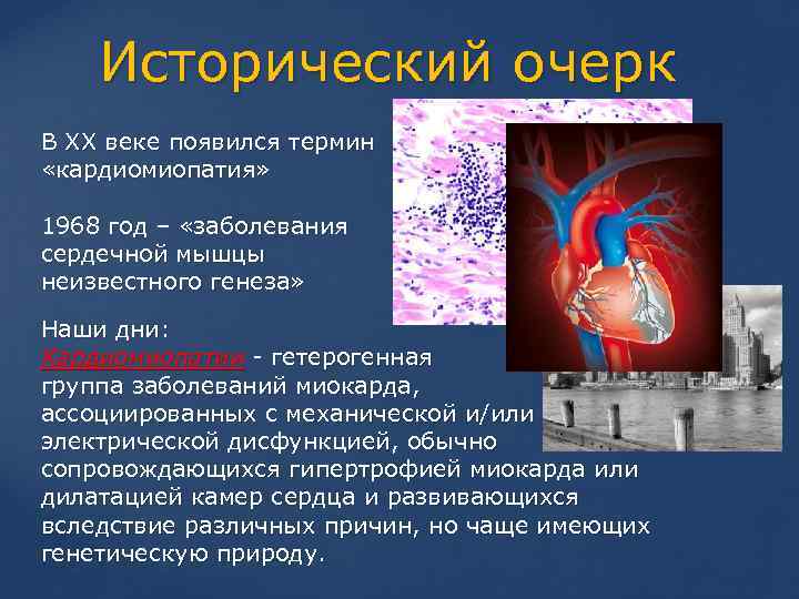 Исторический очерк В XX веке появился термин «кардиомиопатия» 1968 год – «заболевания сердечной мышцы