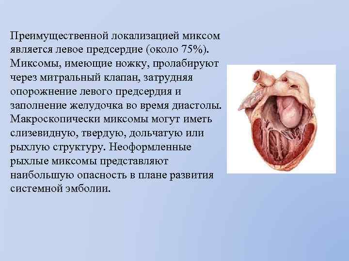 Преимущественной локализацией миксом является левое предсердие (около 75%). Миксомы, имеющие ножку, пролабируют через митральный