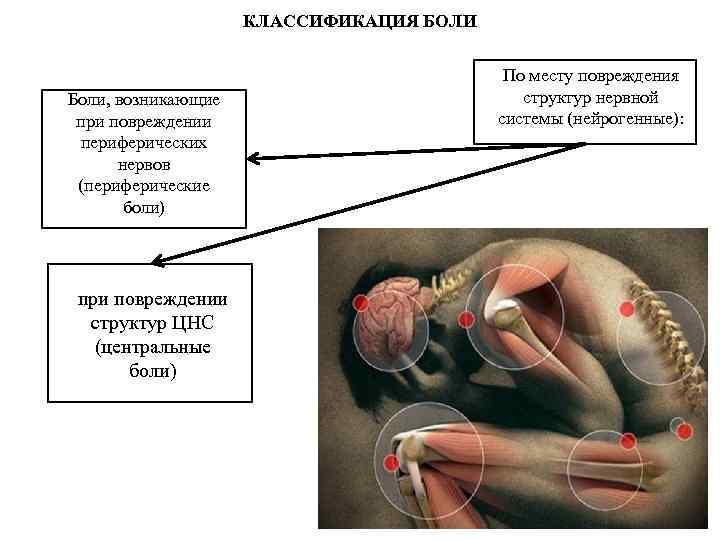 КЛАССИФИКАЦИЯ БОЛИ Боли, возникающие при повреждении периферических нервов (периферические боли) при повреждении структур ЦНС