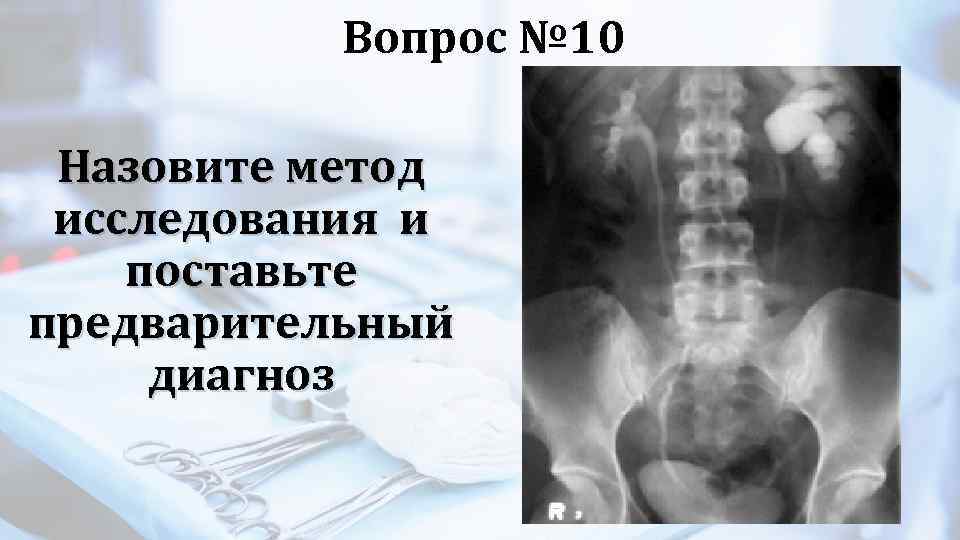 Вопрос № 10 Назовите метод исследования и поставьте предварительный диагноз 