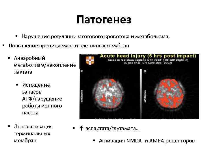 Патогенез § Нарушение регуляции мозгового кровотока и метаболизма. § Повышение проницаемости клеточных мембран §