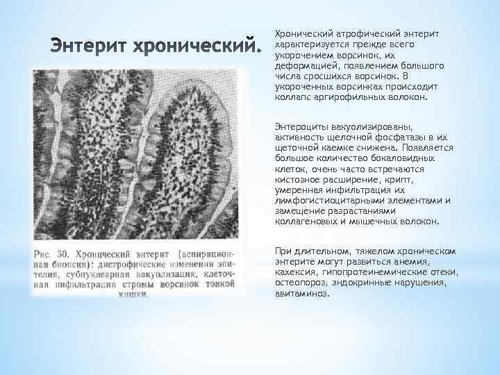 Хронический энтерит. Хронический энтерит гистология. Хронический атрофический энтерит. Хронический энтероколит гистология. Хронический энтерит ворсинки.