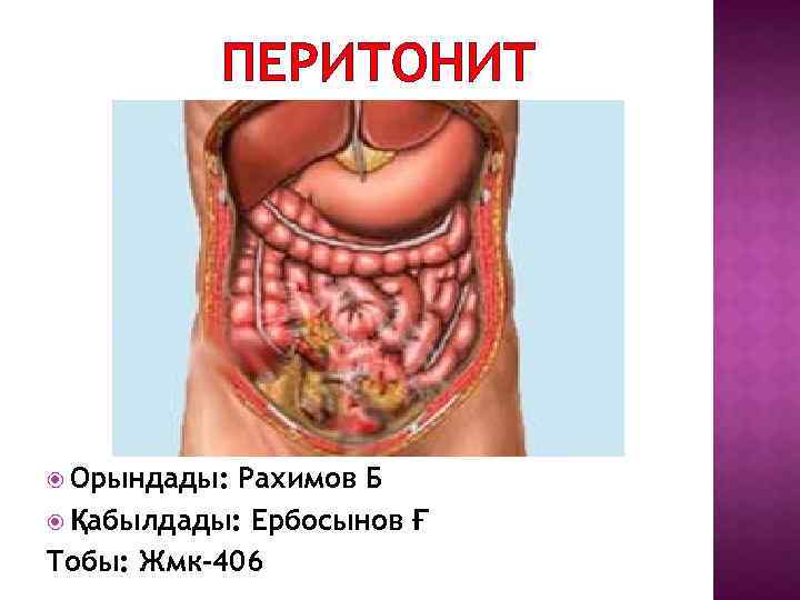 ПЕРИТОНИТ Орындады: Рахимов Б Қабылдады: Ербосынов Ғ Тобы: Жмк-406 