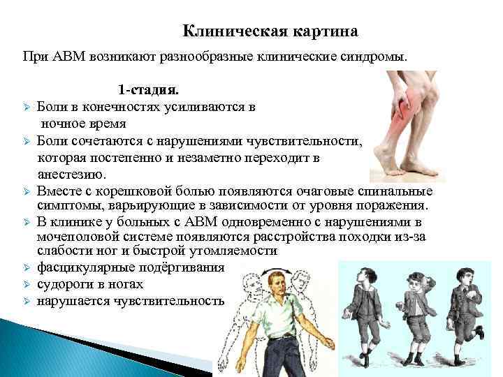 Клиническая картина При АВМ возникают разнообразные клинические синдромы. Ø Ø Ø Ø 1 -стадия.