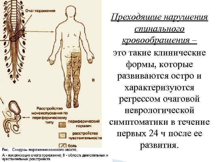 Преходящие нарушения спинального кровообращения – это такие клинические формы, которые развиваются остро и характеризуются