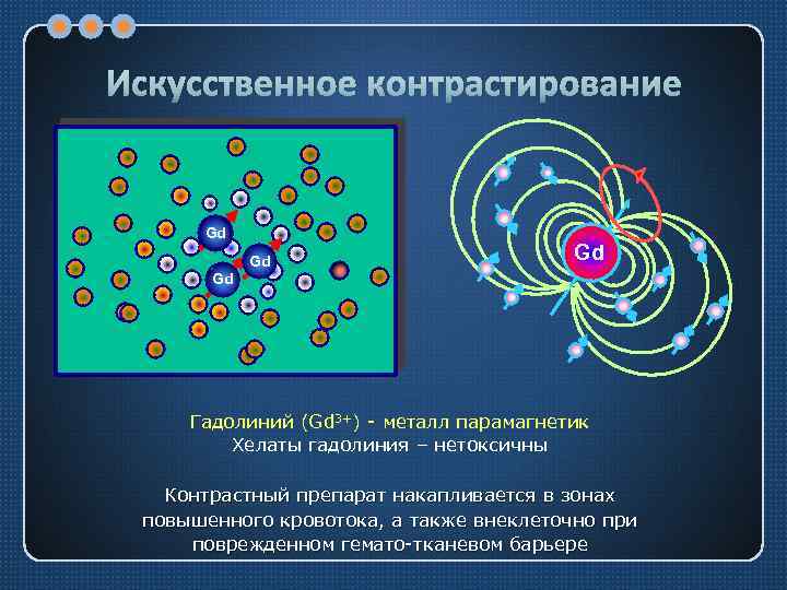 Искусственное контрастирование Gd Gd Гадолиний (Gd 3+) - металл парамагнетик Хелаты гадолиния – нетоксичны