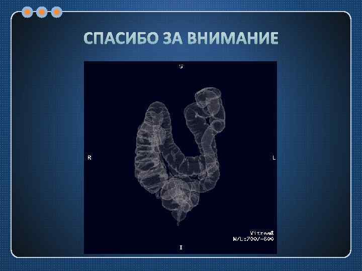 СПАСИБО ЗА ВНИМАНИЕ 