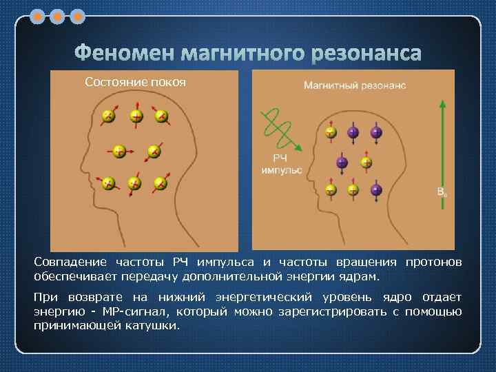 Феномен магнитного резонанса Состояние покоя Совпадение частоты РЧ импульса и частоты вращения протонов обеспечивает